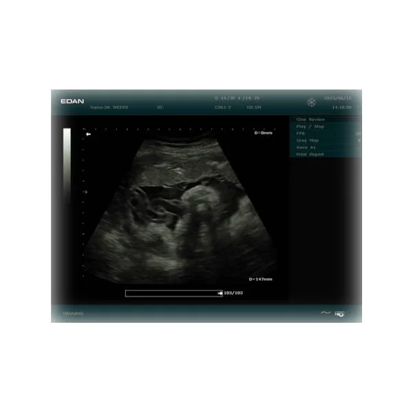 Echographe EDAN DUS 60