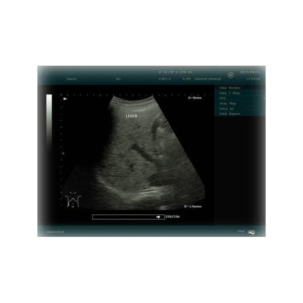 Echographe EDAN DUS 60