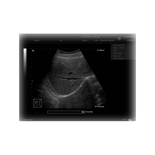 Echographe EDAN DUS 60