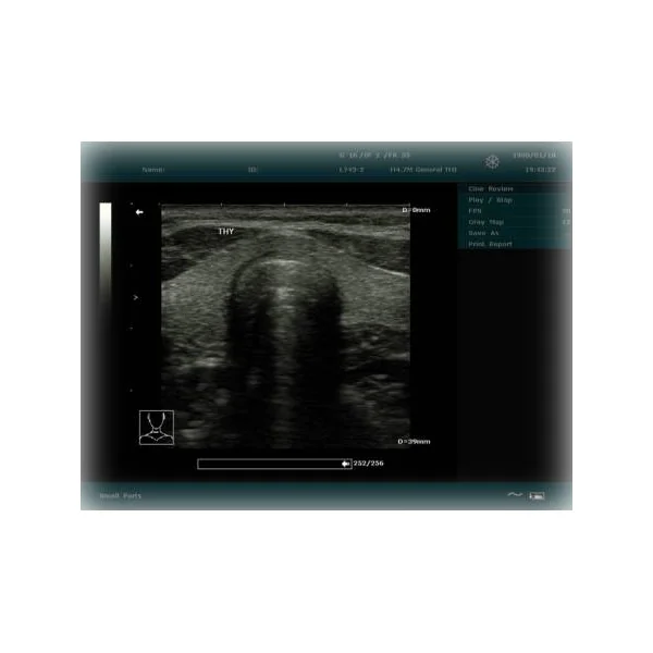 Echographe EDAN DUS 60