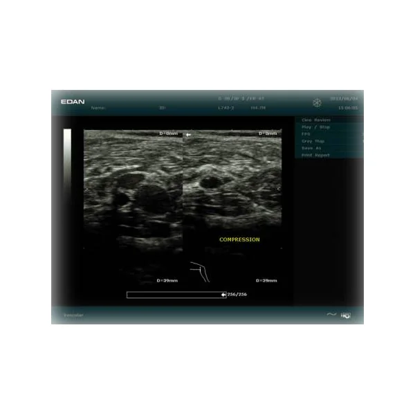 Echographe EDAN DUS 60