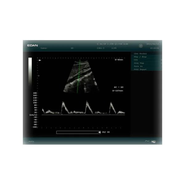 Echographe EDAN DUS 60