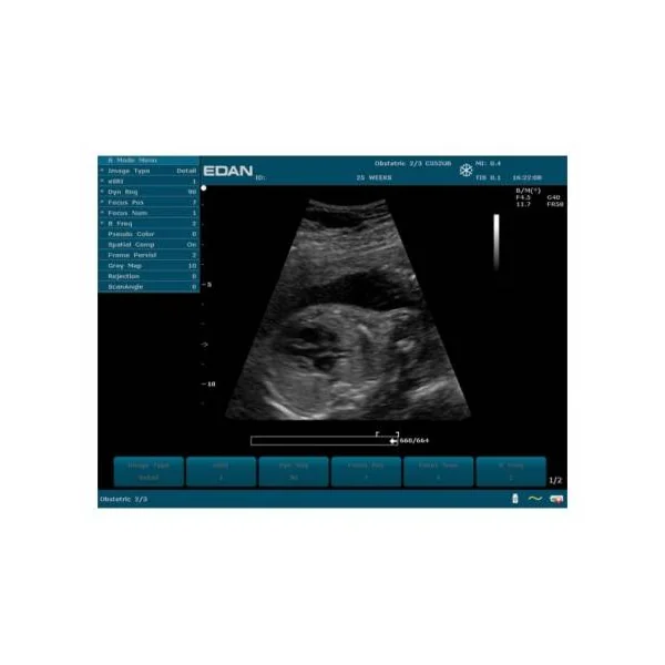 Echographe Portable Edan U50 avec batterie et une sonde