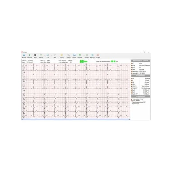 Electrocardiographe Cardiomate PC-ECG Spengler