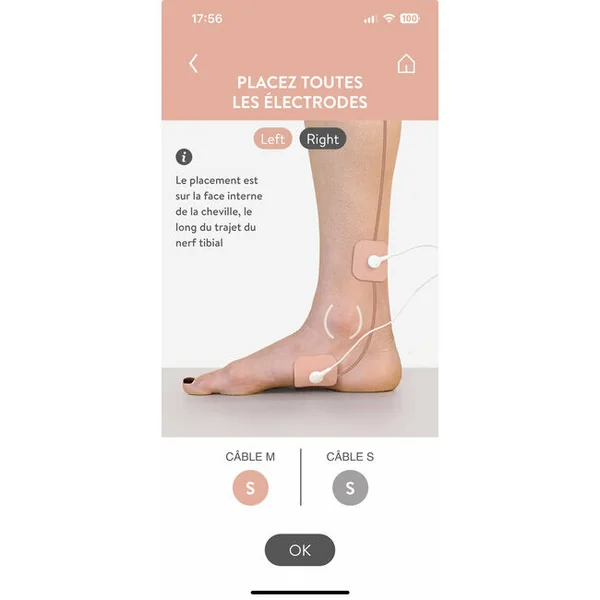 Electrodes S pour dispositif Pinktens
