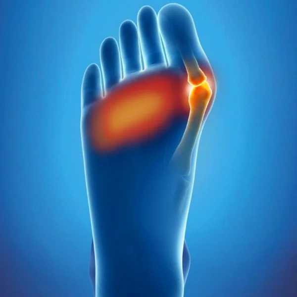 EPITACT Coussinets Double Protection Douleur Plantaire, Hallux Valgus, Oignon - Epithelium 26 - Bt/2