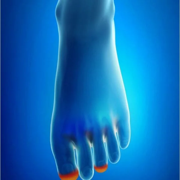 EPITACT Doigtiers Cors Pulpaires, Ongles Incarnés Bleus - Elimine le Cor - Epithelium 26 - Bte/2
