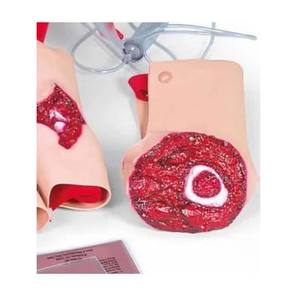 Kit de simulation de blessures II W44520 3b Scientific