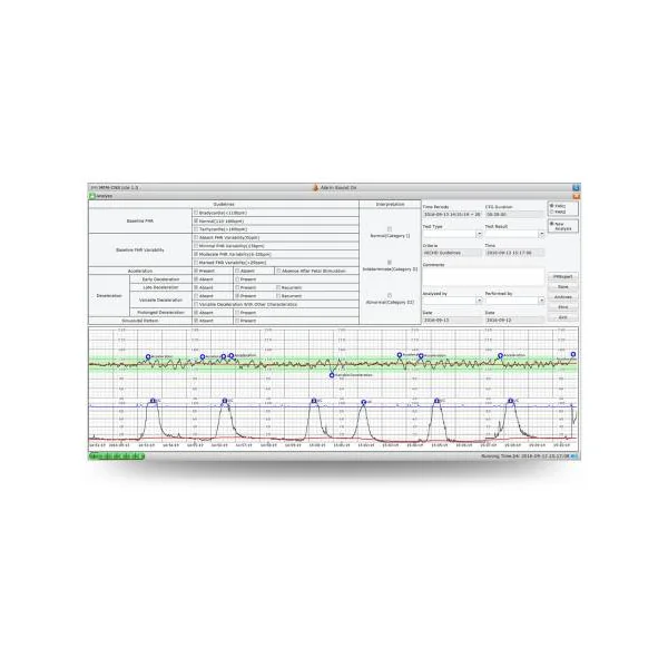 Logiciel MFM-CNS pour cardiotocographe EDAN F3