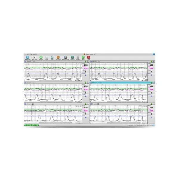 Logiciel MFM-CNS pour cardiotocographe EDAN F3