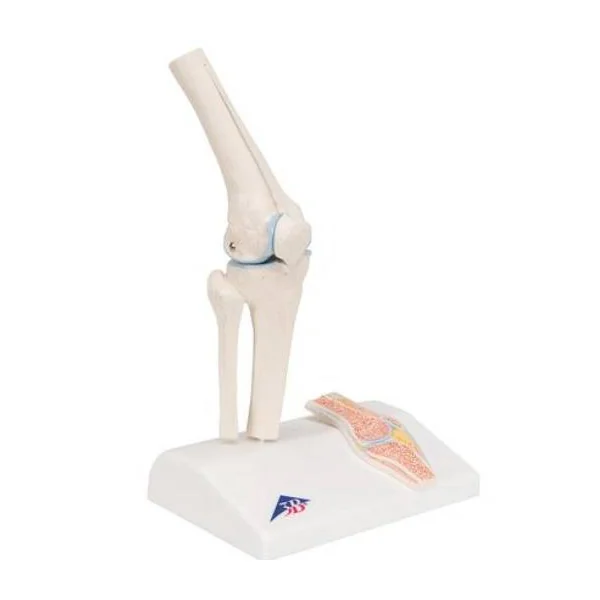 Mini-articulation du genou avec coupe transversale A85/1 3B Scientific