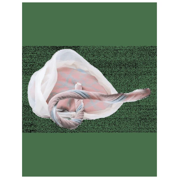 Modèle Anatomique Placenta et Cordon Ombilical W43039 3B Scientific