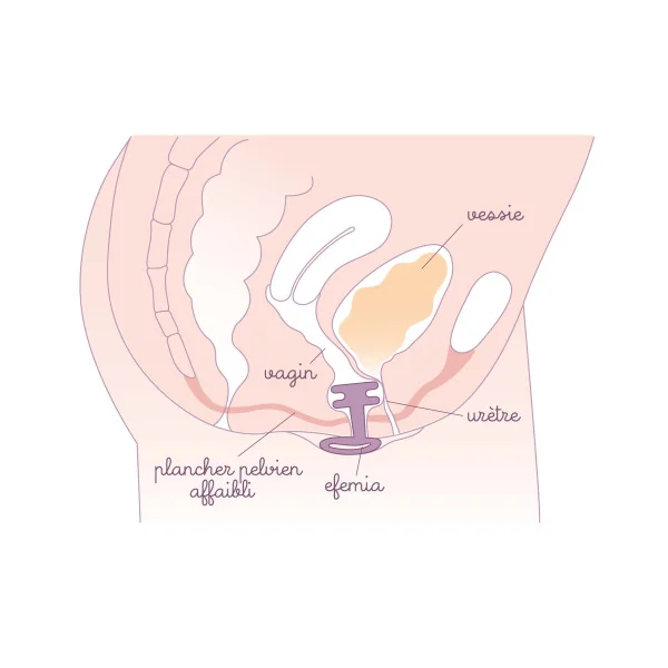 Pack Efemia et rééducation du périnée
